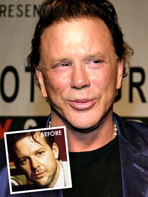 bad-plastic-surgery_Mickey-Rourke.jpg